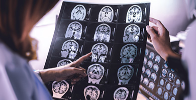 NEUROLOGY