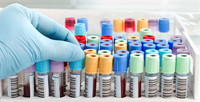 LAB SERVICES